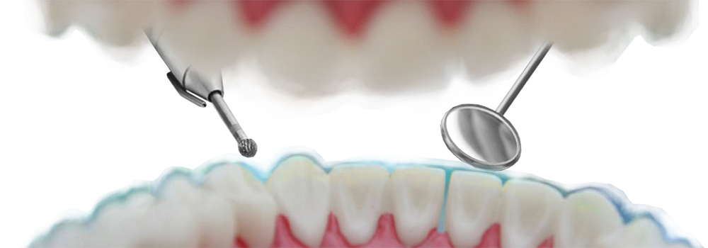 Third slide